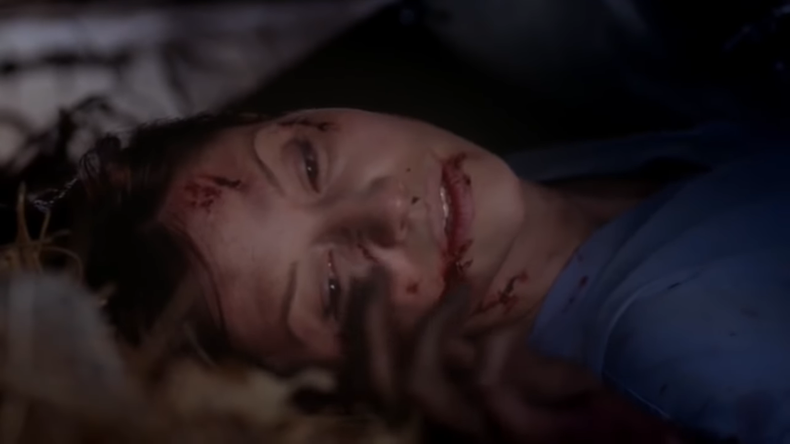 Wounded Lexie lies with her eyes opened and looks at the side